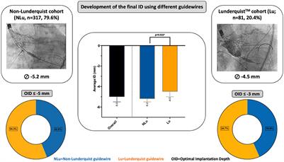 Impact of different guidewires on the implantation depth using the largest self-expandable TAVI device